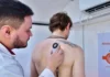 Realizarán testeos dermatológicos gratuitos para prevenir el cáncer de piel