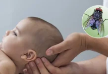 En la misma semana, se confirmó el segundo caso de miasis en el Hospital Pediátrico