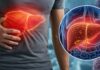 Crecen los casos de hepatitis A en el país y encontraron otro virus poco conocido