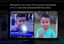 Divisaron a un niño con un “88% de similitudes” morfológicas con Loan