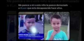 Divisaron a un niño con un “88% de similitudes” morfológicas con Loan